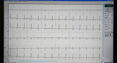 Elettrocardiografia